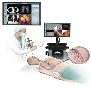 Manufacturers Exporters and Wholesale Suppliers of Bronchoscopy Telangana Andhra Pradesh