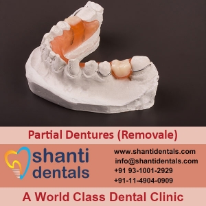 Service Provider of Partial Dentures (Removale) New Delhi Delhi 