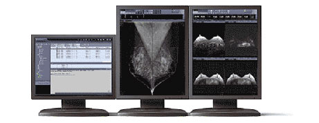 Manufacturers Exporters and Wholesale Suppliers of Infinitt pacs mammography seoul 