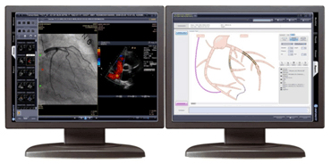 Manufacturers Exporters and Wholesale Suppliers of Infinitt pacs radiology seoul 