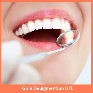 Manufacturers Exporters and Wholesale Suppliers of Smile Makeover New Delhi Delhi Manufacturers Exporters and Wholesale Suppliers of Smile Makeover New Delhi Delhi