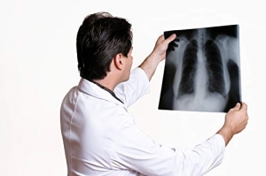 Manufacturers Exporters and Wholesale Suppliers of X-Ray Films Purvi Champaran Bihar