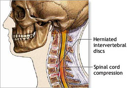 Cervical