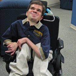 Manufacturers Exporters and Wholesale Suppliers of Muscular Dystrophy Surat Gujarat Muscular Dystrophy