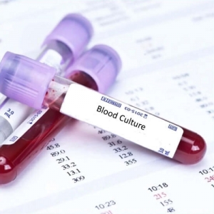 Blood Culture/Sensititvity Services in New Delhi Delhi India