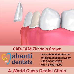 Service Provider of CAD-CAM Zirconia Crown New Delhi Delhi