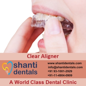 Service Provider of Clear Aligner New Delhi Delhi Clear Aligner