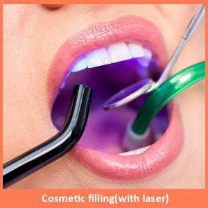 Cosmetic Filling (with Laser)