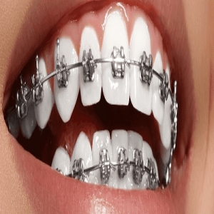 Service Provider of Orthodontic Treatment Yamunanagar Haryana 