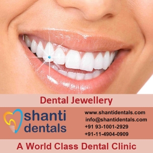 Service Provider of Dental Jewellery New Delhi Delhi