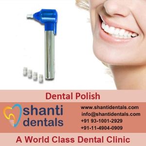 Service Provider of Dental Polish New Delhi Delhi