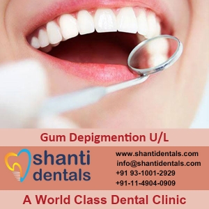 Service Provider of Gum Depigmention Both U/L New Delhi Delhi Gum Depigmention Both U/L