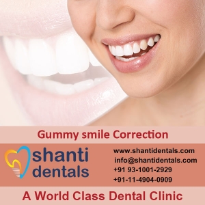 Service Provider of Gummy Smile Correction New Delhi Delhi