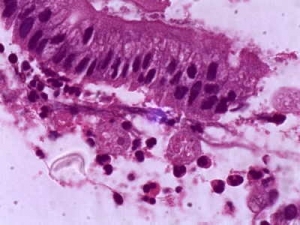 Histopathology