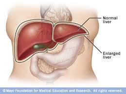 Liver & Liver Related Ailments
