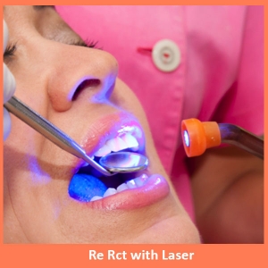 Service Provider of Re Root Canal Treatment with laser New Delhi Delhi