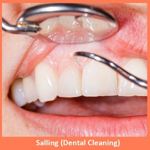 Service Provider of Salling (Dental Cleaning) New Delhi Delhi