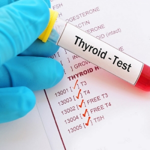 Thyroid Function Test