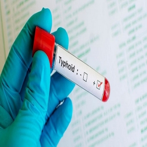 Typhoid Test Services in New Delhi Delhi India