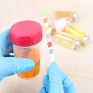 Urine Routine/microscopy