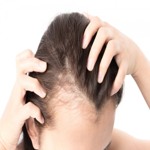 Hair Fall Treatment Services in Yamunanagar Haryana India