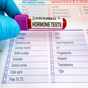 Hormones Test