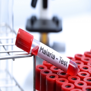 Malaria Test Services in New Delhi Delhi India