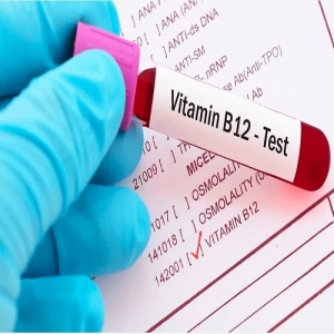 Vitamin B12 Test Services in New Delhi Delhi India