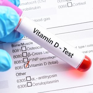 Vitamin D Test Services in New Delhi Delhi India